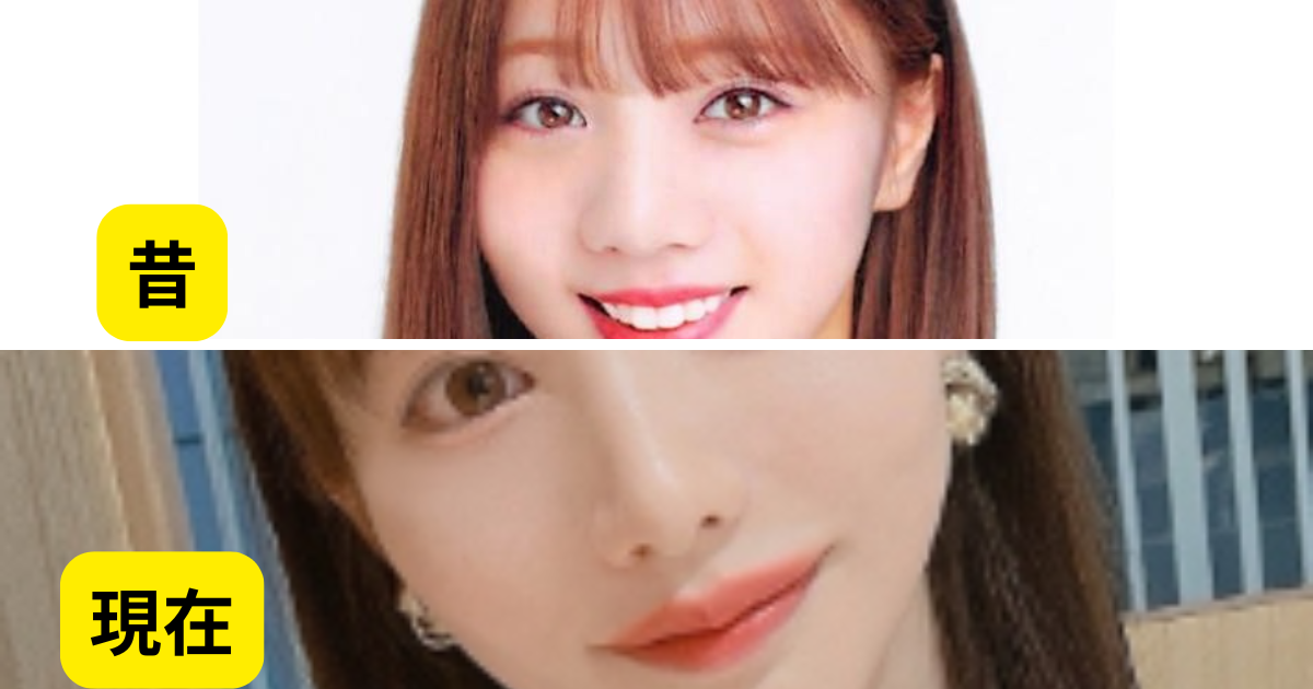 能條愛未が整形して顔変わった！？目と鼻をいじりすぎて前の方がよかったとの声も！？ | Enj…